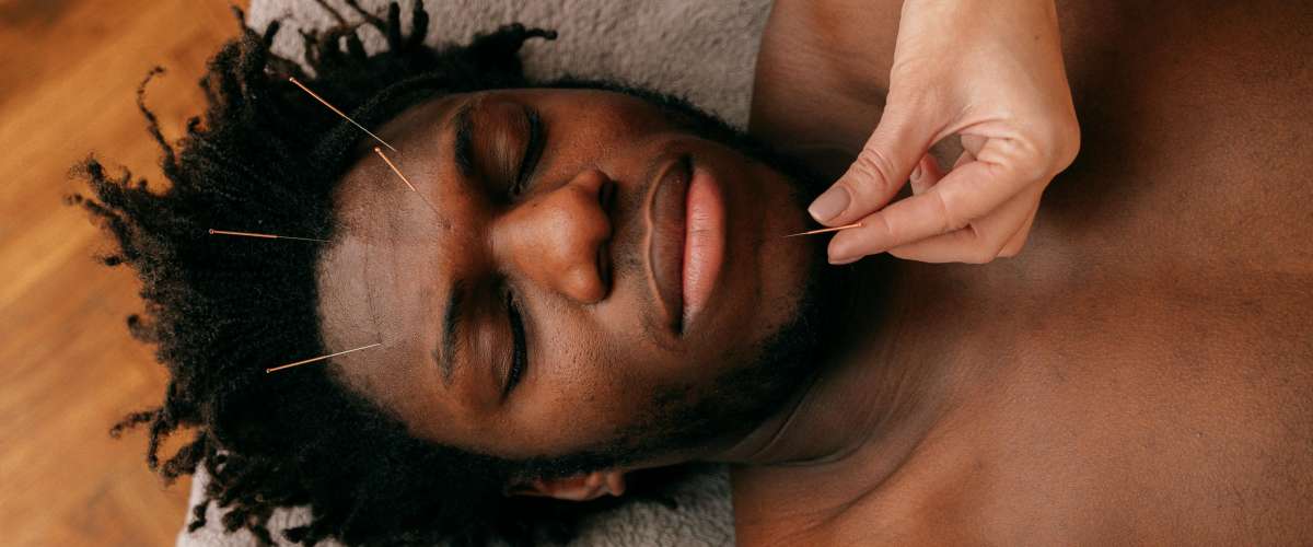 Acouphenes et acupuncture